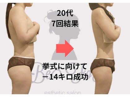 ビーフォー(be for)の写真