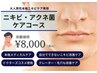 【ニキビケアコース体験¥8000】男の本格ニキビケア
