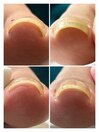 お客様BEFORE/AFTER
