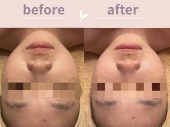 アール(R)/くすみでお悩みの方！