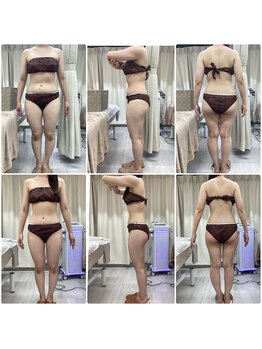 ルピア(L'pur)/3ヶ月でー6キロ