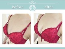 美人バスト 静岡店/バストアップ症例