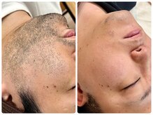 シシエル(CHICIEL)の雰囲気（結果を出すのが難しいヒゲ脱毛やVIO脱毛も当店にお任せください）
