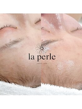 ラペール 岡山店(la perle)/エレクトロポレーション
