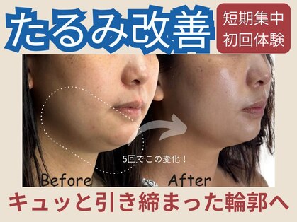 ハス(hasu.)の写真