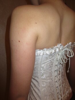 ルメートルセラピー ビューティーサロン(REMETTRE THERAPY)/20代ブライダルエステ成功例