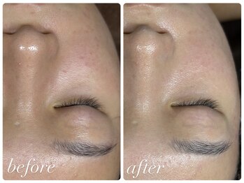 ビノスビューティー(vinos.beauty)/ReLABEAUTEタラソトリートメント