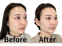 カドモリ 心斎橋(KADOMORI)の雰囲気(美容鍼/小顔矯正/大阪美容鍼/大阪小顔【人気No. 1美容鍼灸★】)