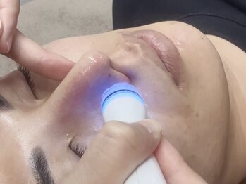 ミヨンラボ(miyon LABO)の写真/「肌がキレイな人は得をする」韓国で話題の肌管理を本格的に受けられるメンズ対応サロン♪症例写真/実績◎