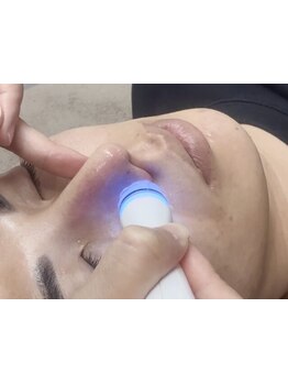 メンズフェイシャル