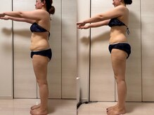 ヨサパーク サノン(YOSA PARK Sanon)/水素で脂肪燃焼促進