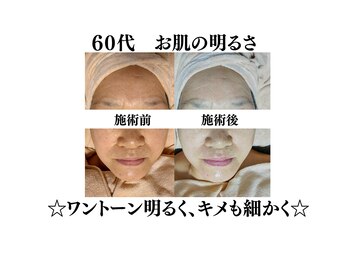 わ心美/ビフォーアフター