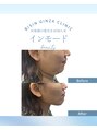 ビシンメディカルサロン(BISIN MEDICAL salon)&nbsp;毛穴/美白/ニキビ/たるみ/シワ/シミ/新宿/小顔/ピーリング/痩身