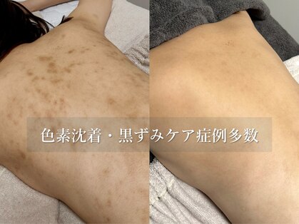 ピブ(PIBU)の写真