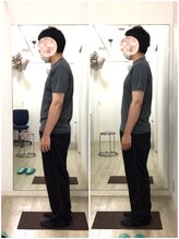 日本橋八重洲整体院/姿勢改善【Before→After】