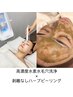 【毛穴×ニキビW集中ケア】　ハイドロハーブピーリング　¥15000