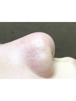 毛穴ケアをしたい