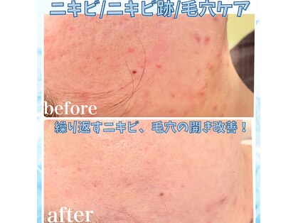 フルオール(FRUOR)の写真