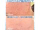 フルオール(FRUOR)の写真