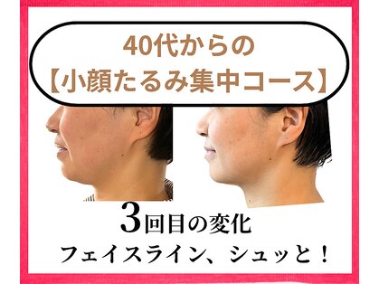 カルナー 武蔵小杉の写真