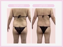 スリムライン 盛岡店(The Slim Line)/before→after