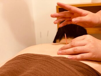 大島はり灸院/鍼は全て使い捨てのものを使用