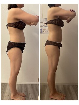 モゼ(moze)/ウルトラ痩身90分