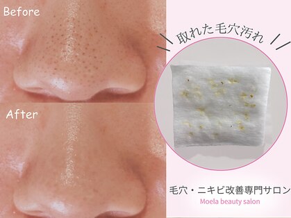 モエラビューティーサロン(Moela beauty salon)の写真