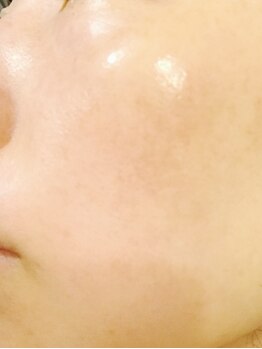 美肌ワークス(美肌works)/エイジングケアでうるツヤ水光肌