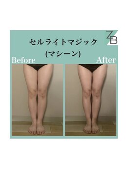 ザラハビューティー(ZARAHA Beauty)/C'elluliteMagic