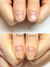 マリーロール 淀屋橋本店(Marie Laure)/自爪育成/深爪矯正/ネイルケア