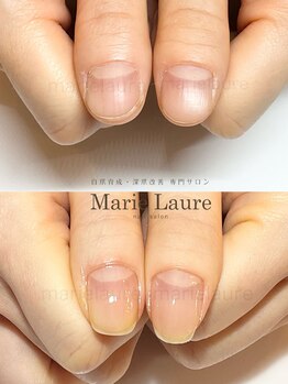 マリーロール 淀屋橋本店(Marie Laure)/自爪育成/深爪矯正/ネイルケア