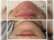 レヴェランジュ(Rebellange)/