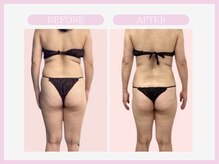 スリムライン 盛岡店(The Slim Line)/before→after