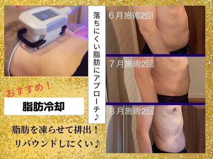 アールアンドエス(R&S)の写真