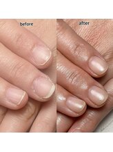 スマイルニコ(smile nico)/