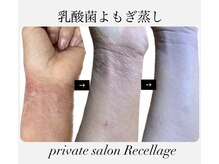 リセラージュ(Recellage)/【よもぎ蒸し】乳菌美人蒸し