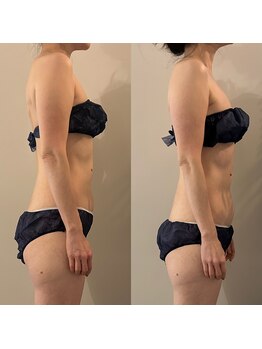 ラナ 京都西院店(Lana)/全身リンパマッサージ