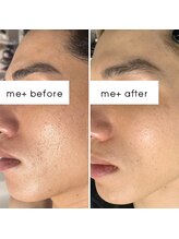 ミタス(Me+)/メンズにも人気◎