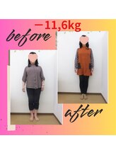 スーパースリムダイエット茅ヶ崎 茅ヶ崎整体院/3ヵ月－11,6ｋｇ減ダイエット♪