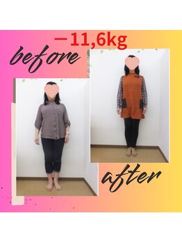 スーパースリムダイエット茅ヶ崎 茅ヶ崎整体院/3ヵ月－11,6ｋｇ減ダイエット♪
