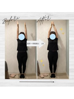 ラクリエ 東加古川院(La Creer)/お客様ビフォーアフター