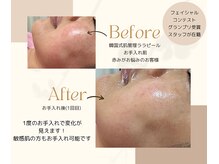 チャロアイト 可部店(Charoite)の雰囲気（グランプリ受賞スタッフ在籍。本気の肌改善しませんか？）