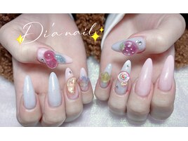 ワンカラ/パラジェル/フィルイン