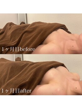 ビュエル(Beauel)/バストフルコース1ヶ月/1回目