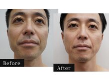 ハル(HAL)の雰囲気(効果即実感★ヒゲ脱毛/デザインもOK《完全予約制/完全個室》)