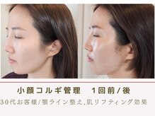 ルナビューティー 赤坂(LUNA beauty)/韓国本場小顔コルギ/骨気