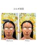 【新規/本気で小顔】本格韓国コルギ+LDMリフト+温熱石膏パック70分 ￥8,800