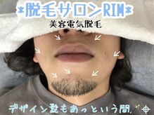 リム 横浜(RIM)/デザイン髭