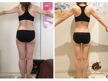 ラ・コンシェル 青葉台店(La Concier)/Before after【青葉台店】
